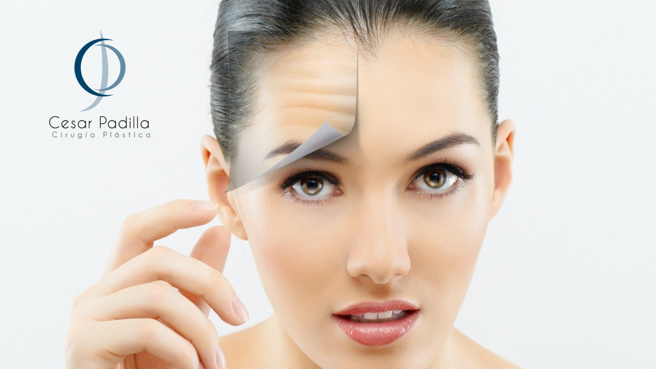 eliminar-arrugas-malaga-botox