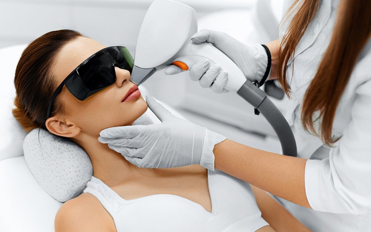 facial-laser