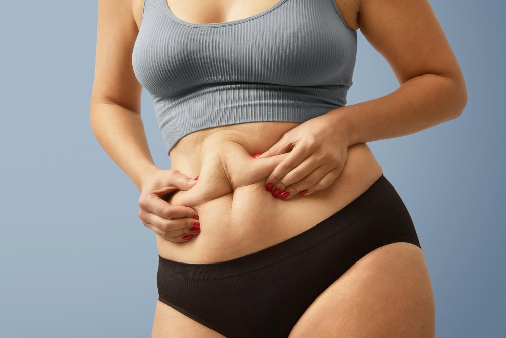 que es diastasis abdominal
