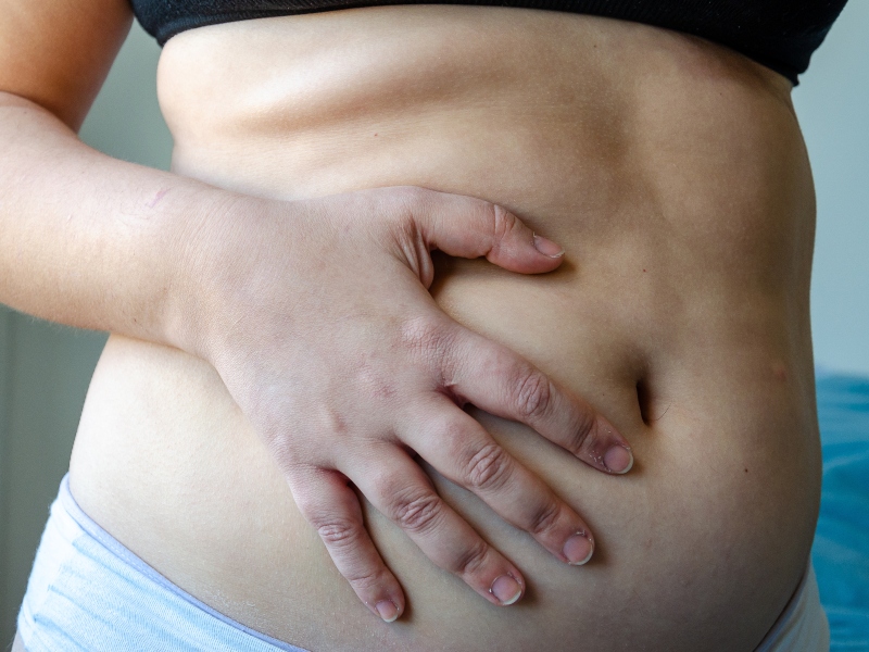 barriga con diastasis abdominal
